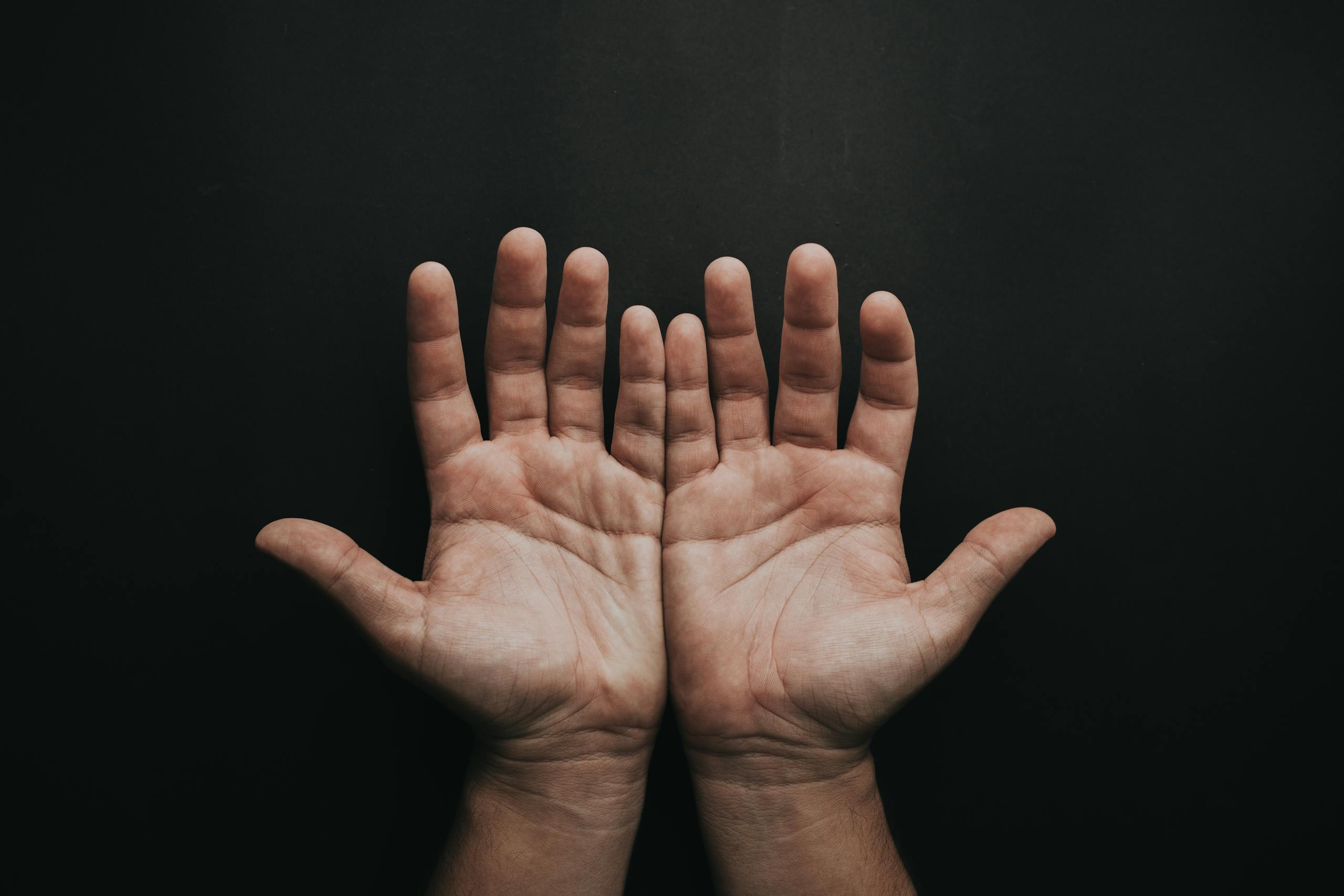 A pair of upturned hands displayed against a dark background, showcasing skin texture.